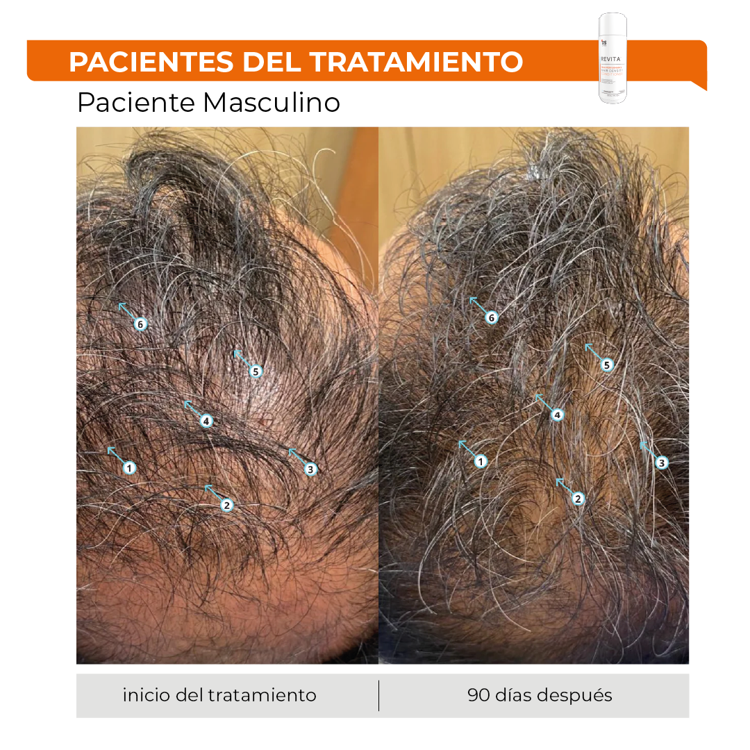 Revita® 205ML | Acondicionador Estimulante para la Densidad Capilar