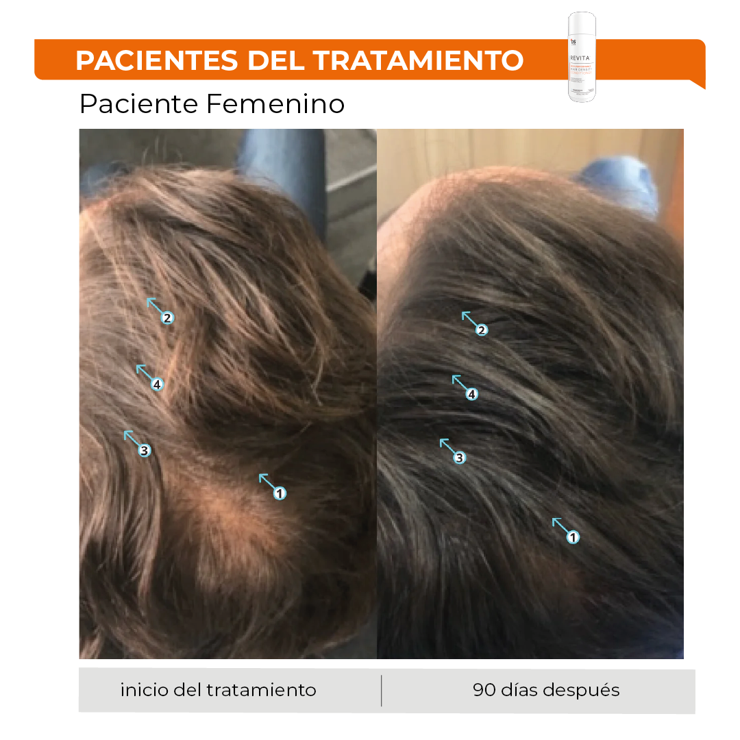 Revita® 205ML | Acondicionador Estimulante para la Densidad Capilar