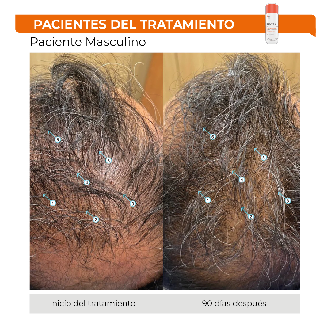 Revita® 205ML | Shampoo Estimulante para la Densidad Capilar