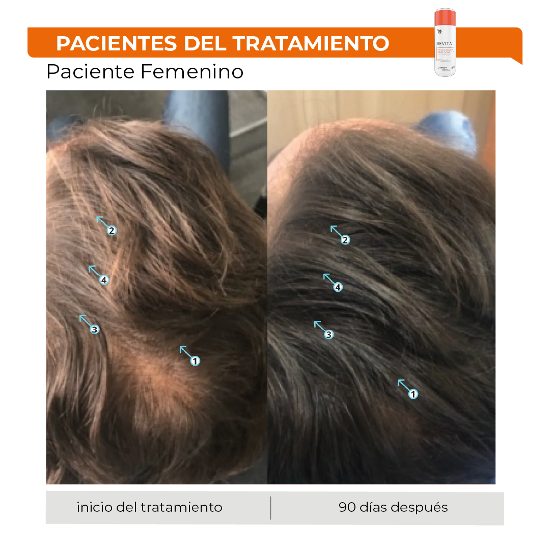 Revita® 205ML | Shampoo Estimulante para la Densidad Capilar
